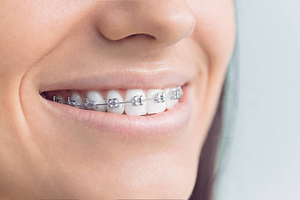 Full Mouth Reconstruction in Bunkie, LA